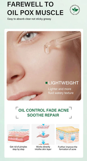 FORT Salicylic Acid Serum – Anti-Acne & Dark Spot Correcting (30ml)