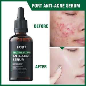 FORT Salicylic Acid Serum – Anti-Acne & Dark Spot Correcting (30ml)