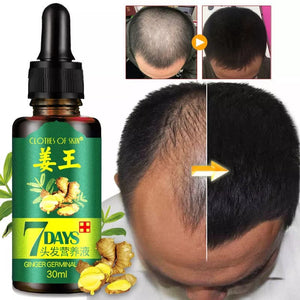 7-Day Hair Growth Serum – Herbal Anti-Hair-Fall Scalp Treatment (30ml)
