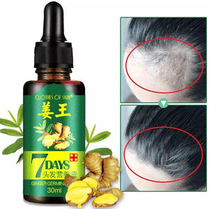 7-Day Hair Growth Serum – Herbal Anti-Hair-Fall Scalp Treatment (30ml)