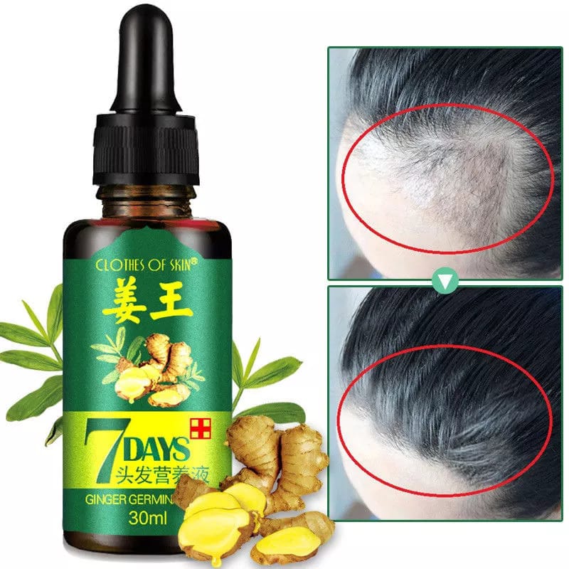 7-Day Hair Growth Serum – Herbal Anti-Hair-Fall Scalp Treatment (30ml)