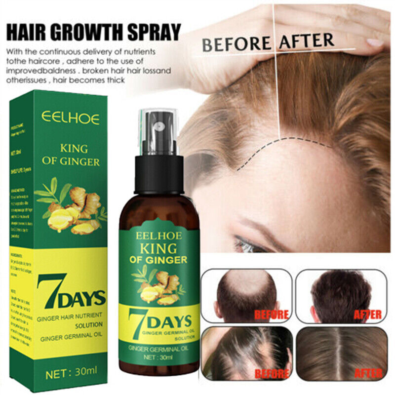 7-Day Hair Growth Serum – Herbal Anti-Hair-Fall Scalp Treatment (30ml)